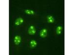 PGBD5 Antibody in Immunocytochemistry (ICC/IF)