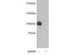 PGBD5 Antibody in Western Blot (WB)