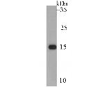 CD3 zeta (CD247) Antibody in Western Blot (WB)