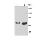 CD62E (E-selectin) Antibody in Western Blot (WB)