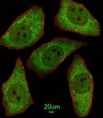 MSRA Antibody in Immunocytochemistry (ICC/IF)