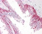 PHLDA2 Antibody in Immunohistochemistry (Paraffin) (IHC (P))