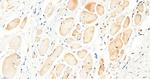 BTRC Antibody in Immunohistochemistry (Paraffin) (IHC (P))