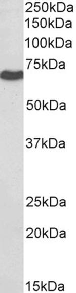 BTRC Antibody in Western Blot (WB)