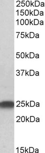 LIN7B Antibody in Western Blot (WB)