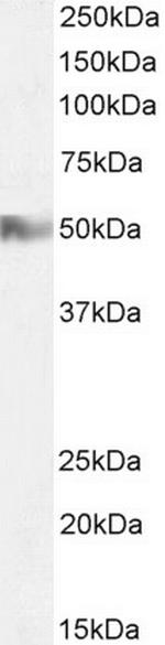 HRH2 Antibody in Western Blot (WB)