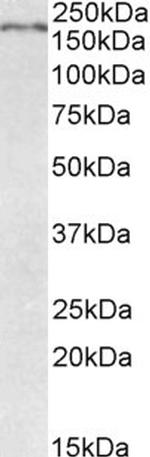 ROBO1 Antibody in Western Blot (WB)