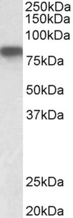 Hemopexin Antibody in Western Blot (WB)