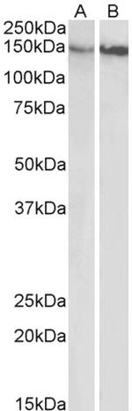 Integrin beta 1 (CD29) Antibody in Western Blot (WB)