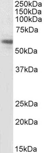 ACVR1 Antibody in Western Blot (WB)