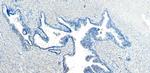 CEP290 Antibody in Immunohistochemistry (Paraffin) (IHC (P))