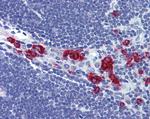 RASSF2 Antibody in Immunohistochemistry (Paraffin) (IHC (P))