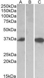 Mast Cell Chymase Antibody in Western Blot (WB)