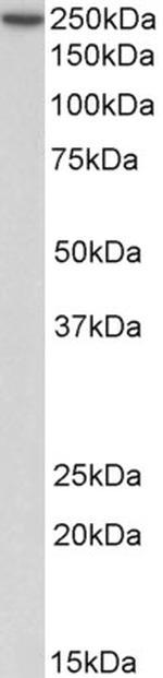 MYH9 Antibody in Western Blot (WB)