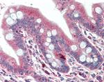 DTX2 Antibody in Immunohistochemistry (Paraffin) (IHC (P))