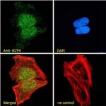 IKZF4 Antibody in Immunocytochemistry (ICC/IF)