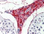 TIAM2 Antibody in Immunohistochemistry (Paraffin) (IHC (P))