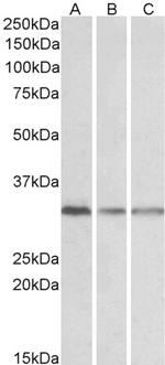 RACK1 Antibody in Western Blot (WB)