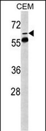 FKBP10 Antibody in Western Blot (WB)