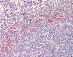 APOBEC3D Antibody in Immunohistochemistry (Paraffin) (IHC (P))