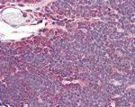 IDH3A Antibody in Immunohistochemistry (Paraffin) (IHC (P))