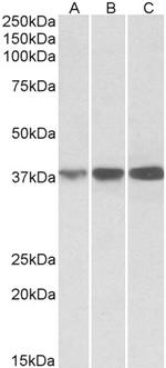 IDH3A Antibody in Western Blot (WB)