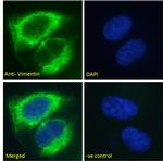 Vimentin Antibody in Immunocytochemistry (ICC/IF)