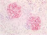 Vimentin Antibody in Immunohistochemistry (Paraffin) (IHC (P))