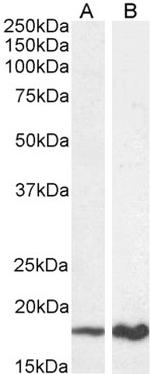 p19ARF Antibody in Western Blot (WB)