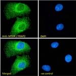 mTOR Antibody in Immunocytochemistry (ICC/IF)