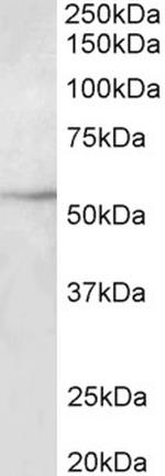 Beta III Tubulin Antibody in Western Blot (WB)