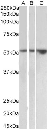 KIM-1 Antibody in Western Blot (WB)