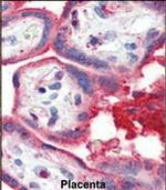 ApoA1 Antibody in Immunohistochemistry (Paraffin) (IHC (P))