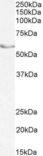 NR5A2 Antibody in Western Blot (WB)