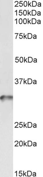 TPM4 Antibody in Western Blot (WB)