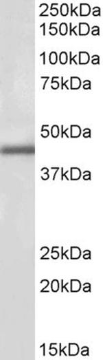 IP6K3 Antibody in Western Blot (WB)