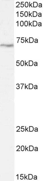 LIMK2 Antibody in Western Blot (WB)