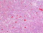 GSTM4 Antibody in Immunohistochemistry (Paraffin) (IHC (P))