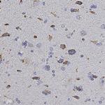 HSP60 Antibody in Immunohistochemistry (Paraffin) (IHC (P))