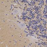 alpha Synuclein Antibody in Immunohistochemistry (Paraffin) (IHC (P))