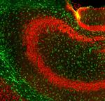 GFAP Antibody in Immunohistochemistry (PFA fixed) (IHC (PFA))