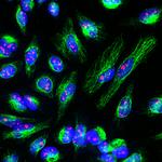 Fibrillarin Antibody in Immunocytochemistry (ICC/IF)