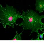 MECP2 Antibody in Immunocytochemistry (ICC/IF)