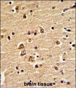 EN2 Antibody in Immunohistochemistry (Paraffin) (IHC (P))