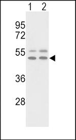 Vitronectin Antibody in Western Blot (WB)