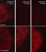 Phospho-CD104 Integrin beta 4 (Tyr1494) Antibody in Immunocytochemistry (ICC/IF)