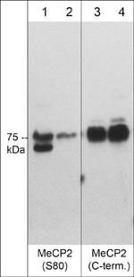 Phospho-MECP2 (Ser80) Antibody in Western Blot (WB)