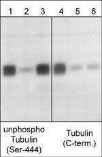 Beta III Tubulin Antibody in Western Blot (WB)