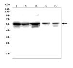 TRIM6 Antibody in Western Blot (WB)