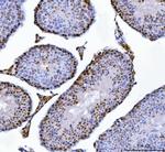 MBNL1 Antibody in Immunohistochemistry (Paraffin) (IHC (P))